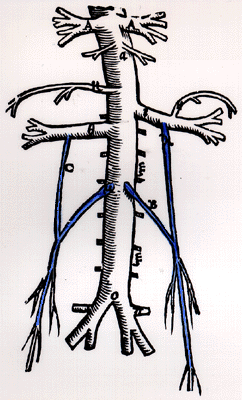 Image of spermatic vein