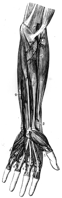 Image of an Enlarged Median Artery Replacing the Radial and Ulnar in the
Supply of Palmar Arteries to Half the Digits