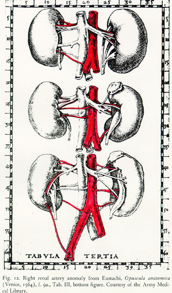 Image of renal artery variation