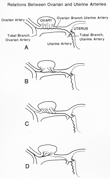 Image of relations between ovarian and uterine arteries