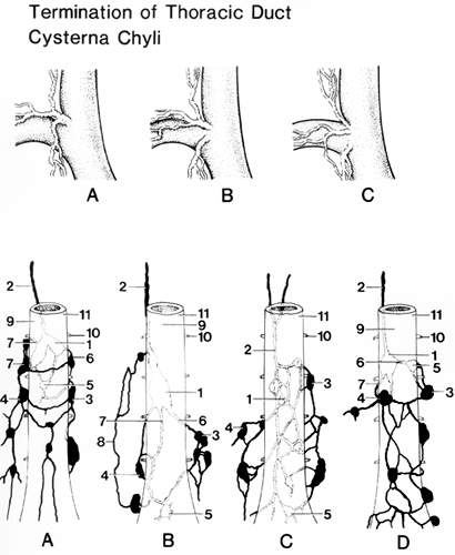 Image of some variations in termination of the thoracic duct and the cisterna chyli
