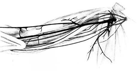 Image of brachialis superficialis inferior
