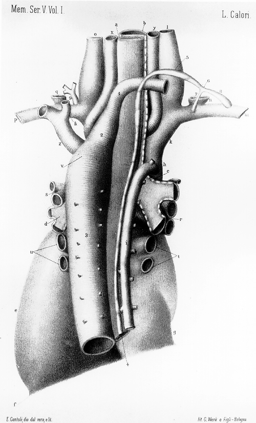 Image of thoracic duct variant