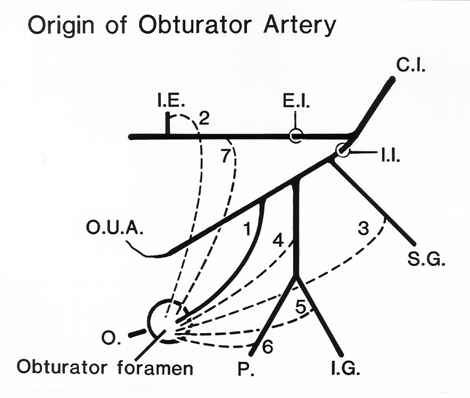 Image of origin of the obturator artery