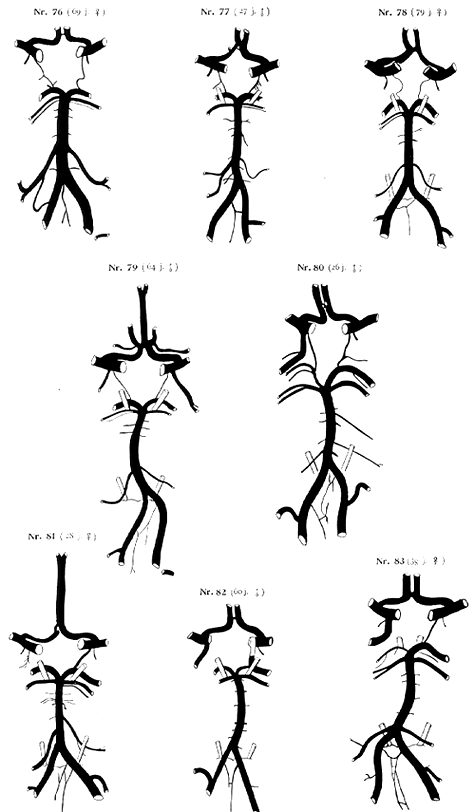 Image of variations in circle of Willis