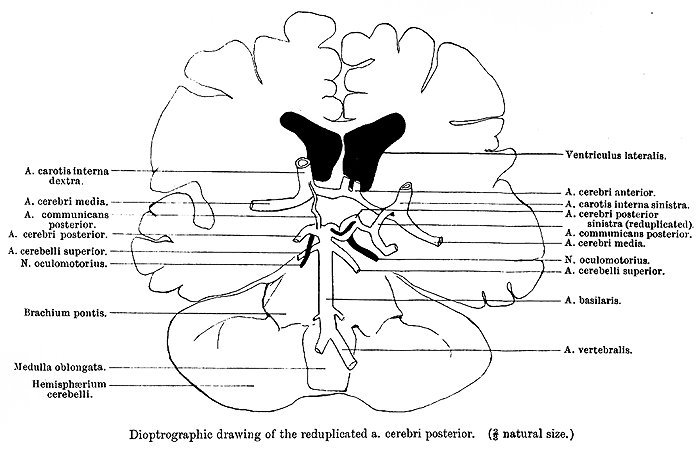 Image of posterior cerebral artery