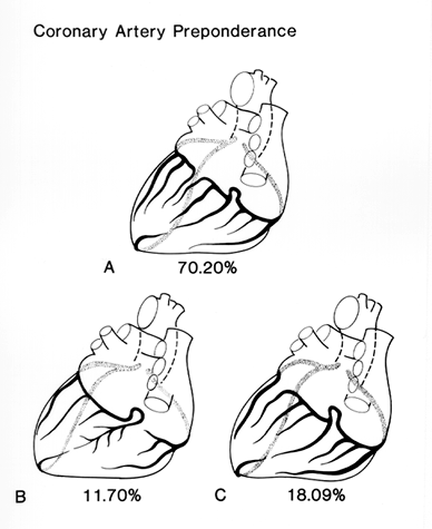 Image of coronary artery preponderance