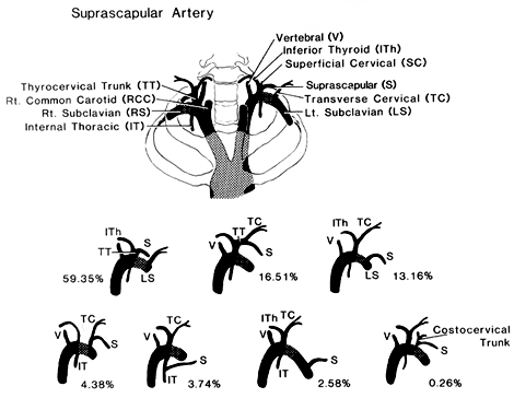 Image of suprascapular artery variations