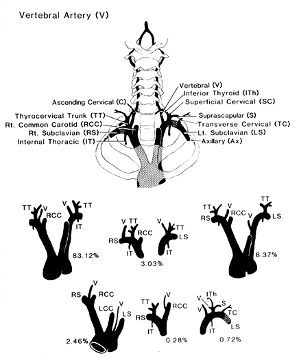Image of vertebral artery variations