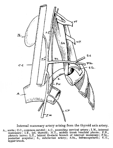 Image of internal thoracic artery