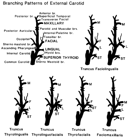 Image of branching patterns of hte external cartoid artery