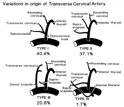 Image of variations in origin of traverse cervical artery