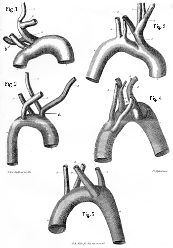 Image of unusual branches of aortic arches