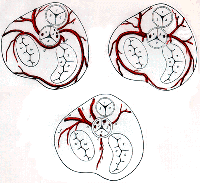 Image of ostia of coronary arteries