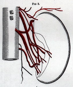 Image of six renal arteries