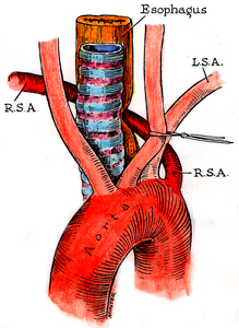 Image of right subclavian artery