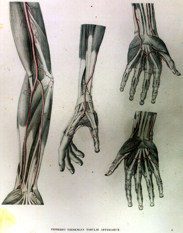 Image of palmar arches and rudimentary radial artery