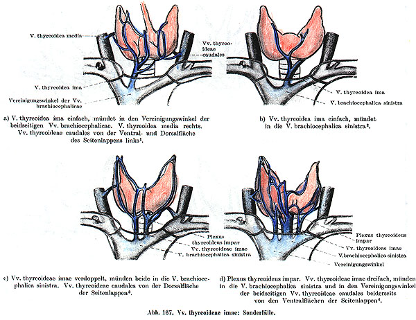 Image on thyroideae ima artery variations