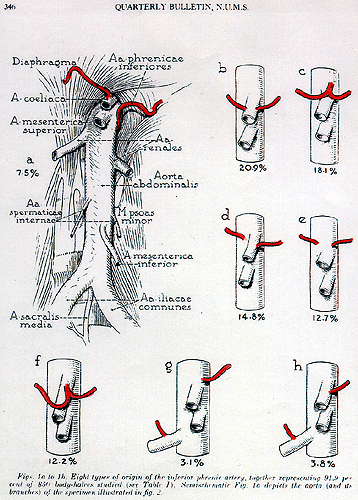 Image of inferior phrenic arteries