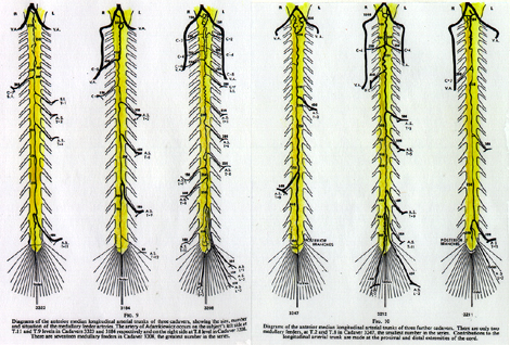 Image of the variable anterior median longitudinal artery of the spinal cord