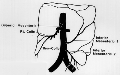 Image of double inferior mesenteric artery