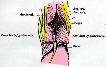 Image of popliteal artery and vein entrapped by third head of gastrocnemius