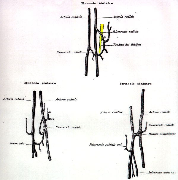 Image of anastomoses between the radial and ulnar arteries in the arm