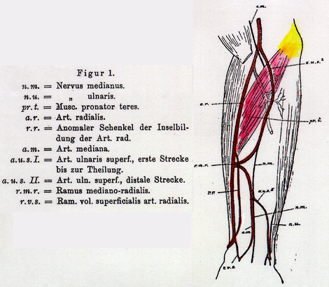 Image of arterial variations in the human arm, forearm, and hand
