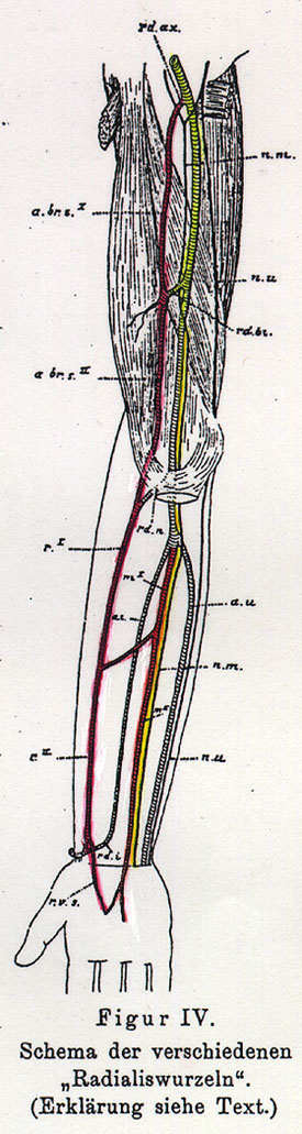 Image of arterial variations in the human arm, forearm, and hand