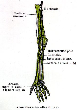 Image of arterial variations found in the arm, forearm and hand