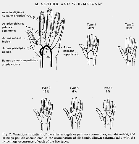 Images Of Arteries. Palmar digital arteries