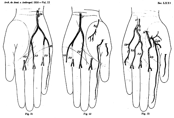 Image of some variations in deep palmar arch