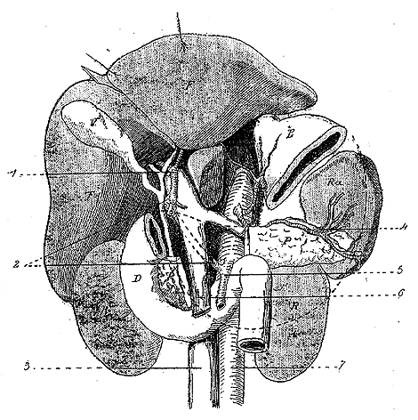 Image of hepatic artery from superior mesenteric artery