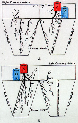 Image of arterioradiographic study of coronary a perponderance