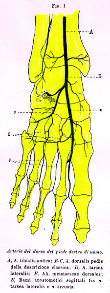 Image of dorsalis pedis artery variations