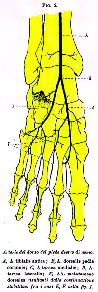 Image of dorsalis pedis artery variations