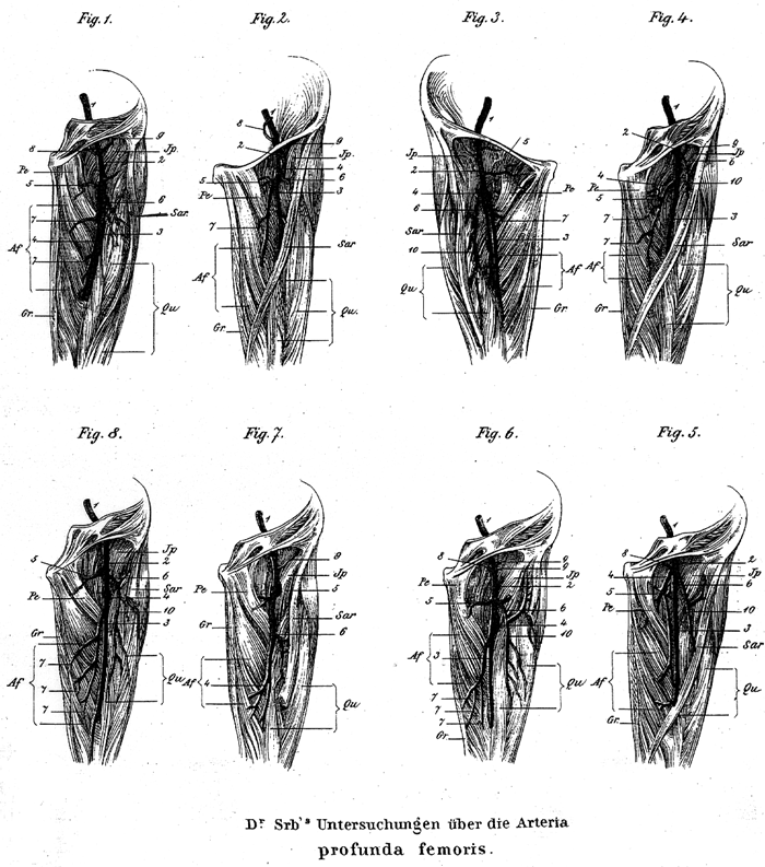 Image of profunda femoris artery variations