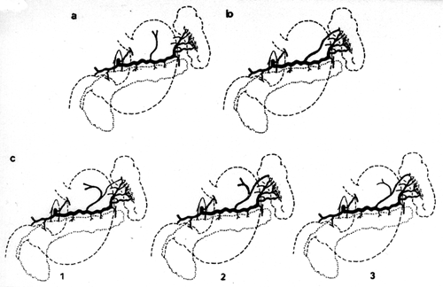 Image of splenic artery branches