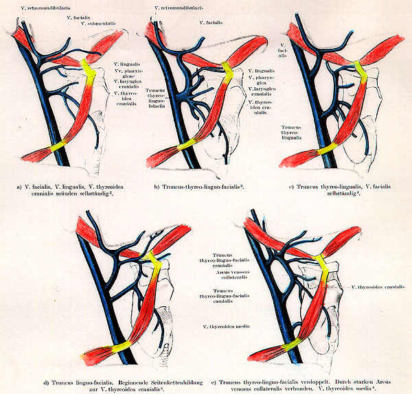Image of some internal jugular variations