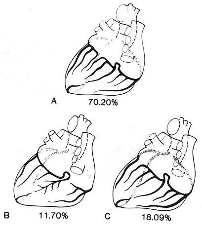 Image of coronary artery preponderance