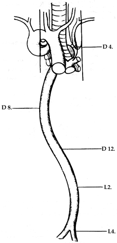 Image of right aortic arch and sinuous aorta