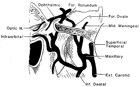 Image of absence of internal carotid artery