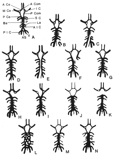 Image of variations of circle of Willis and related vessels