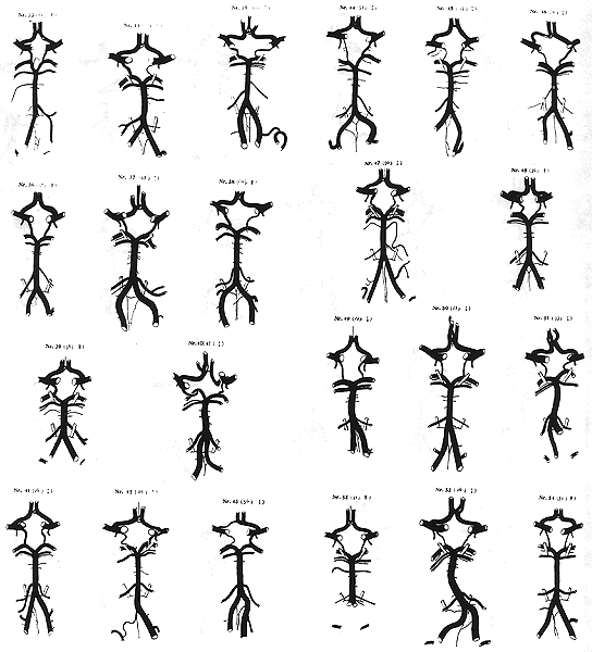 Image of variations in circle of willis