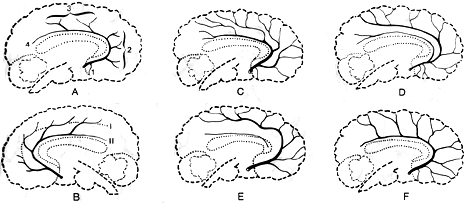 Image of anterior cerebral artery