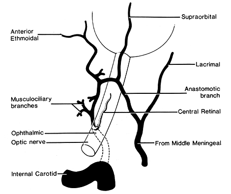 Image of variation in ophthalmic artery