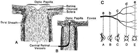 Image of variations in appearance of central retinal artery at optic papilla