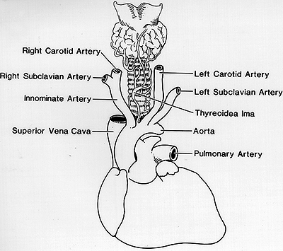 Image of thyroid Ima artery
