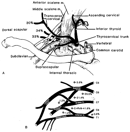 Image of variations in origin of transverse cervical artery