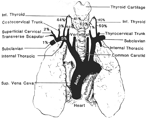 Image of cervical origins of esophageal arteries